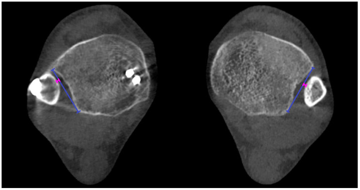 Figure 9