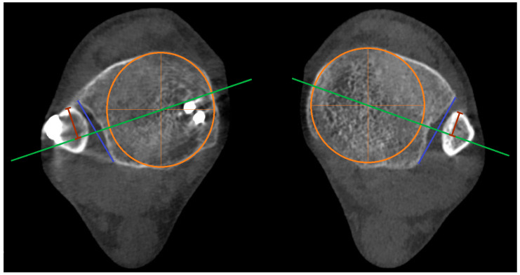 Figure 11