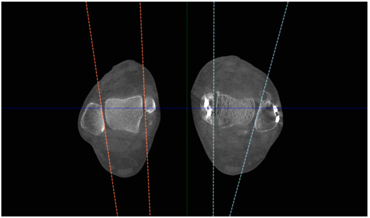 Figure 12