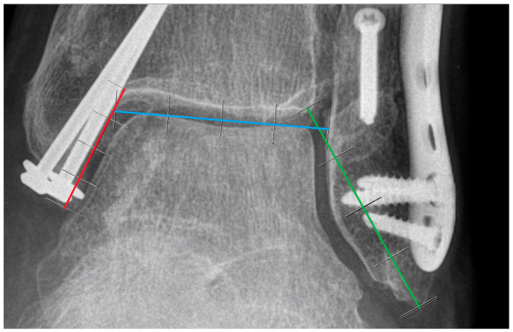 Figure 13