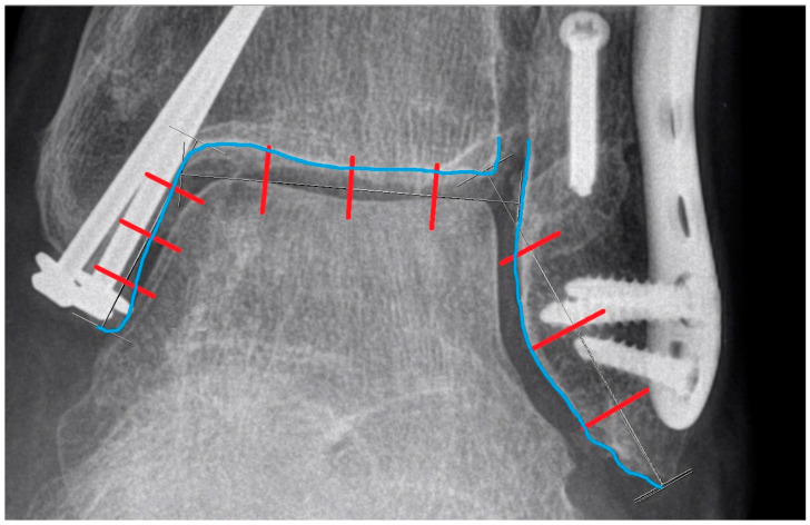 Figure 14