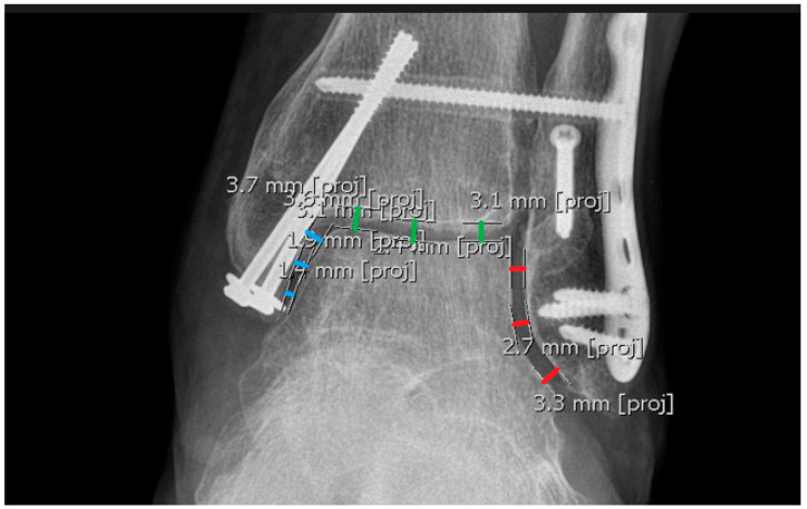 Figure 15