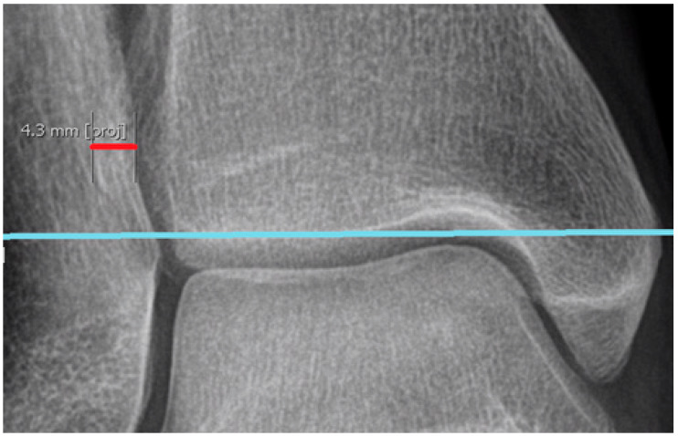 Figure 16