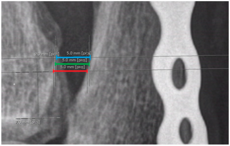 Figure 17