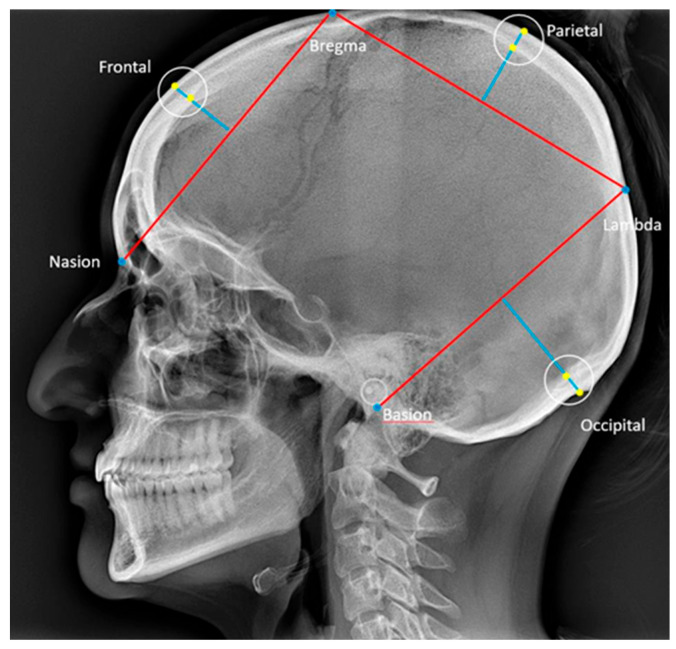 Figure 4
