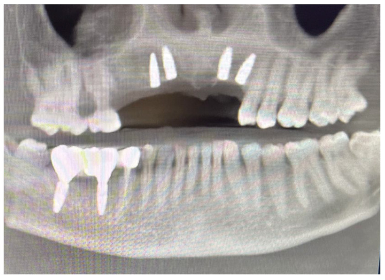 Figure 7