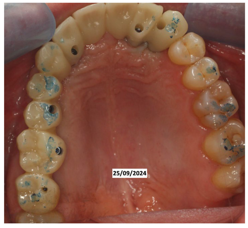 Figure 9