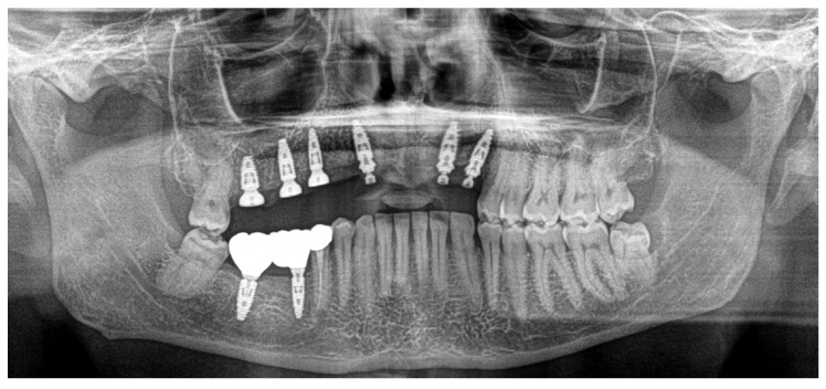 Figure 10