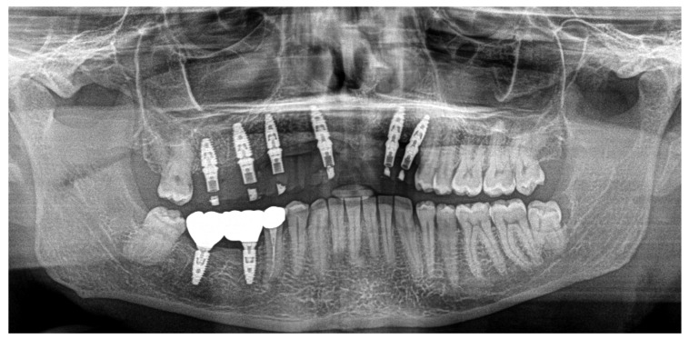 Figure 11