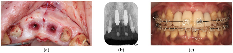 Figure 9