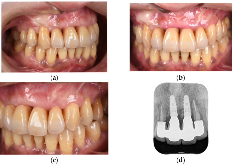 Figure 10