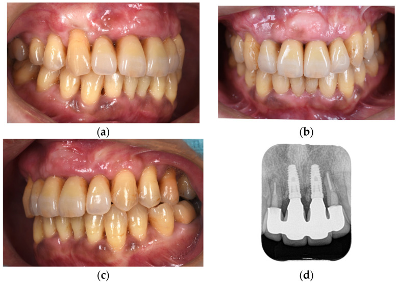 Figure 12