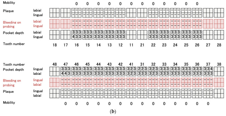 Figure 14