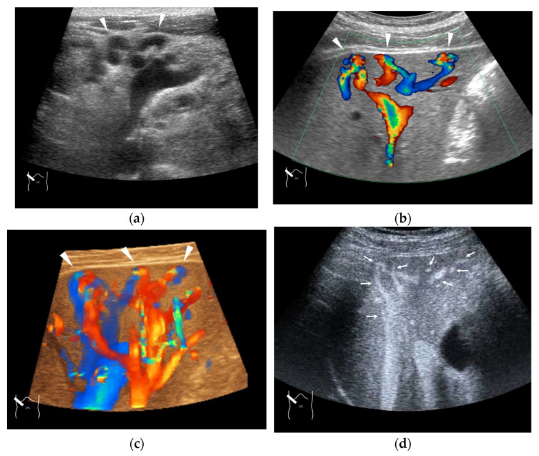Figure 11