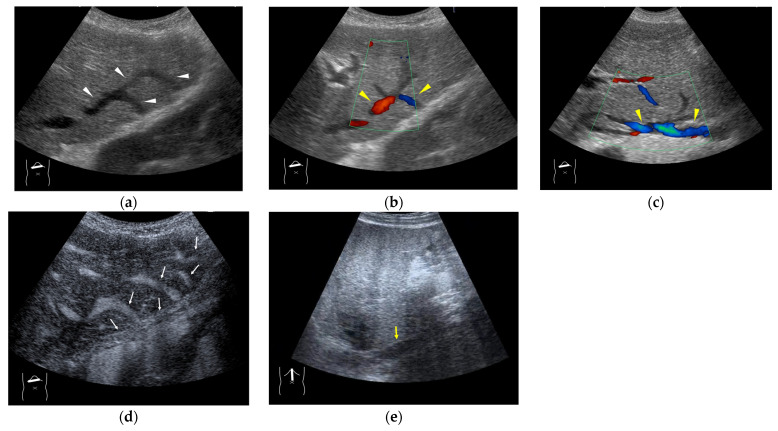 Figure 13