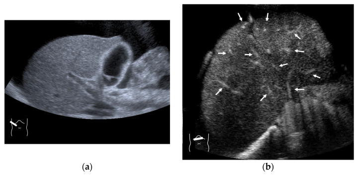 Figure 14
