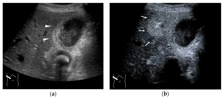 Figure 15