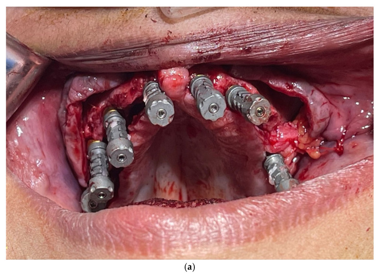 Figure 6
