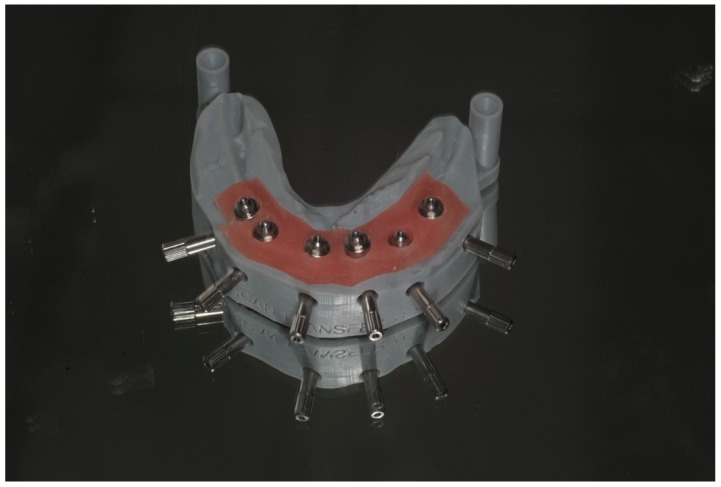 Figure 11