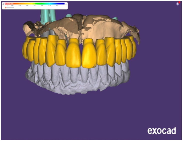 Figure 13