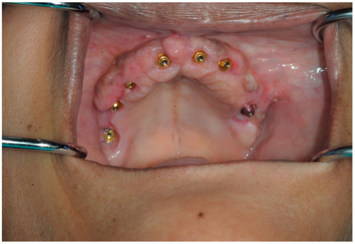 Figure 14