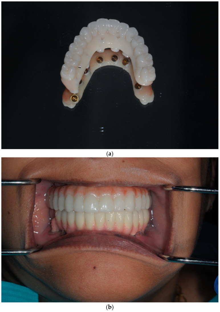 Figure 17