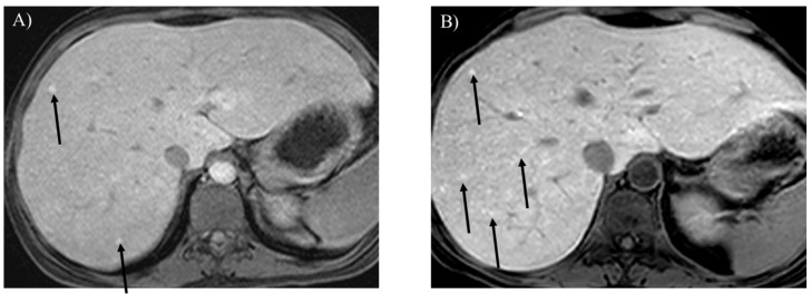 Figure 9
