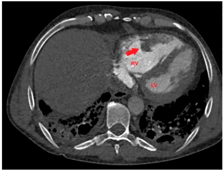 Figure 4