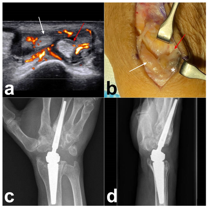 Figure 4