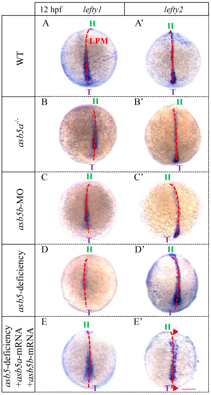 Figure 11