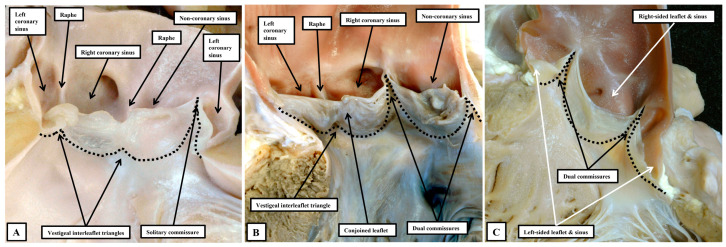 Figure 13