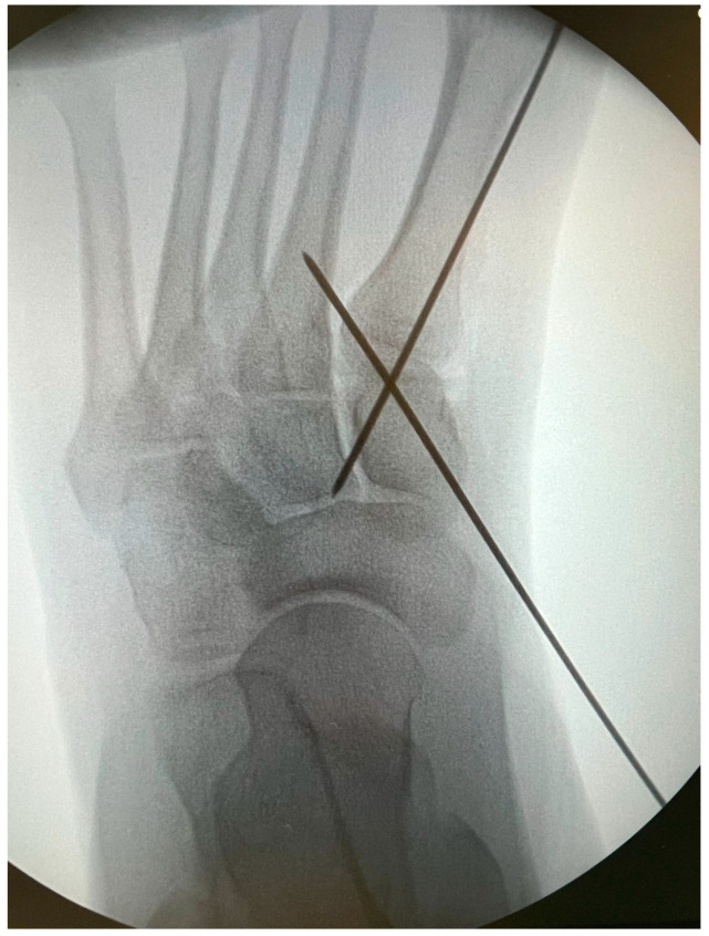 Figure 6