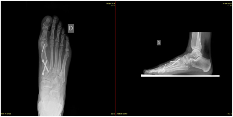 Figure 11