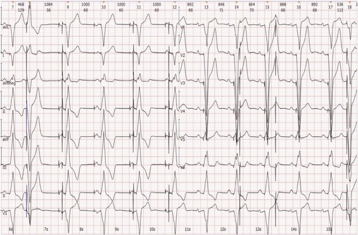 FIGURE 3