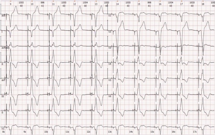 FIGURE 1