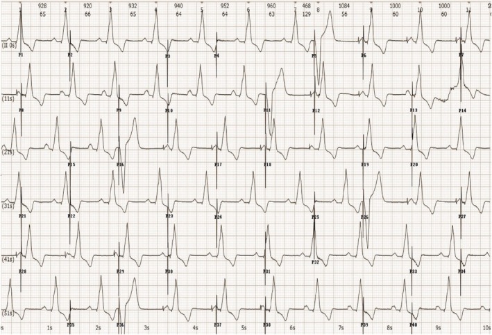 FIGURE 4