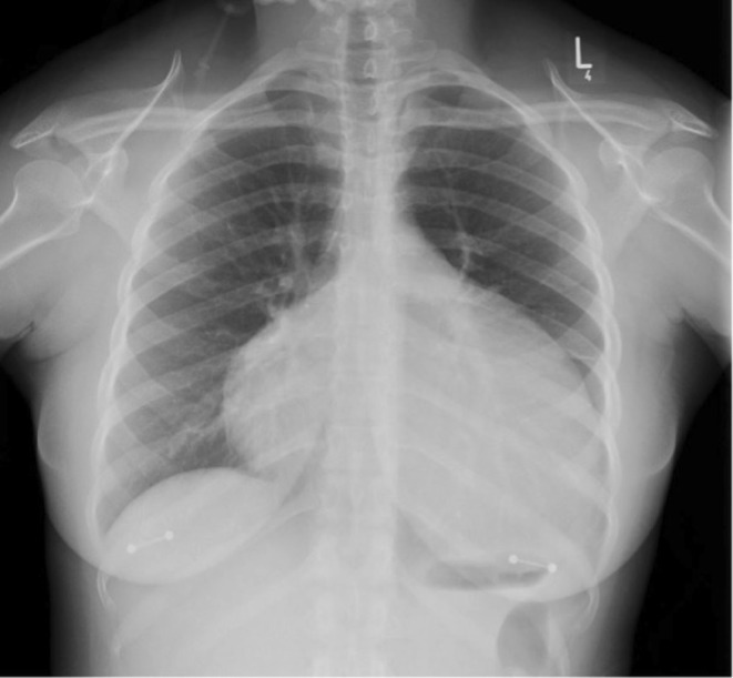 FIGURE 1