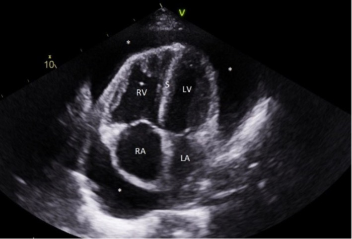 FIGURE 4