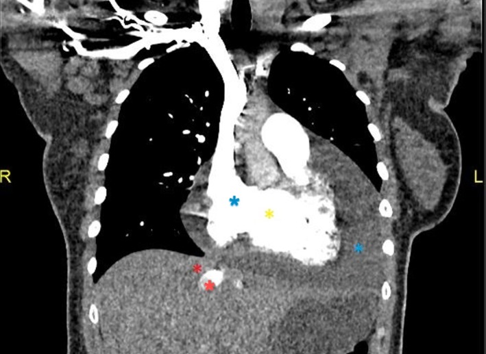 FIGURE 3