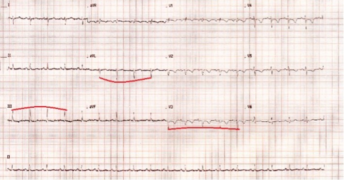 FIGURE 2