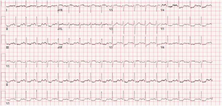FIGURE 1