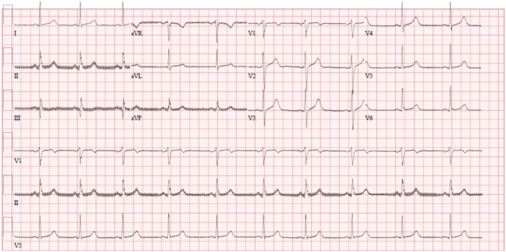 FIGURE 2