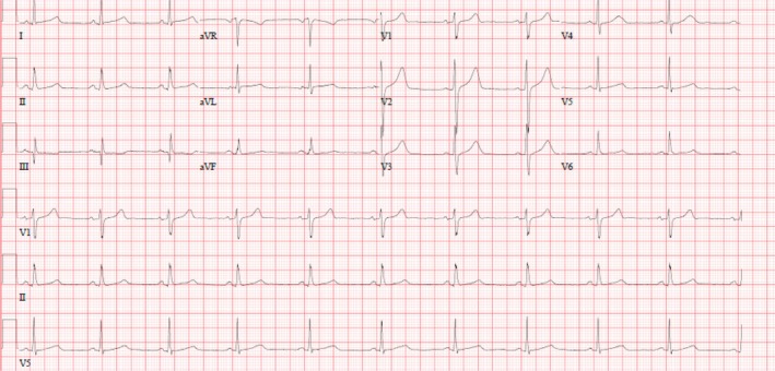FIGURE 3