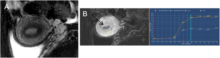 Figure 2