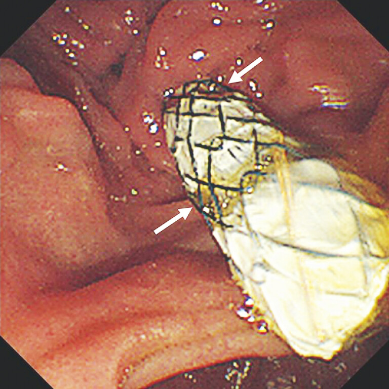 Fig. 2
