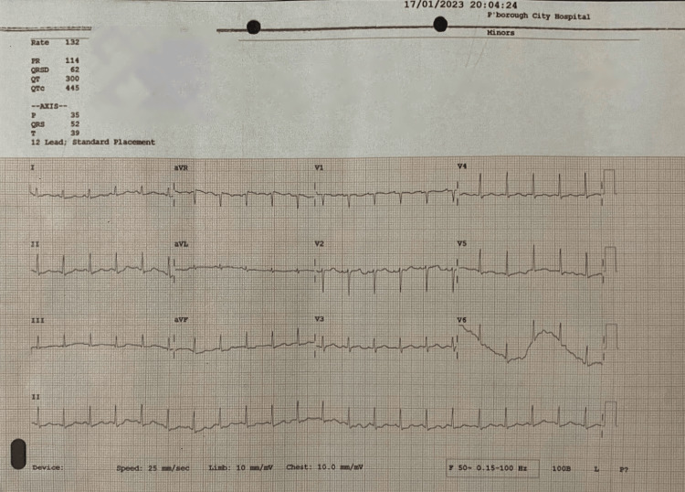 Figure 2