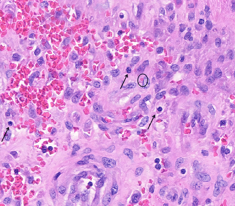 Figure 11