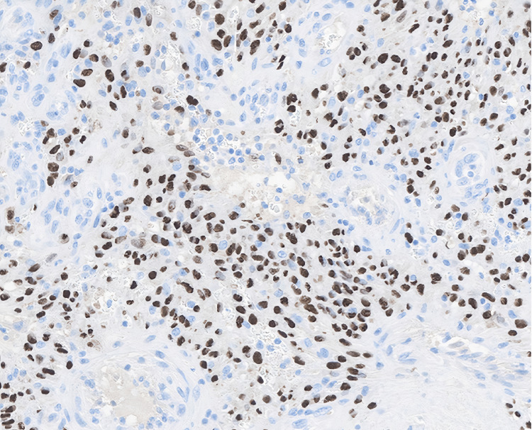 Figure 12