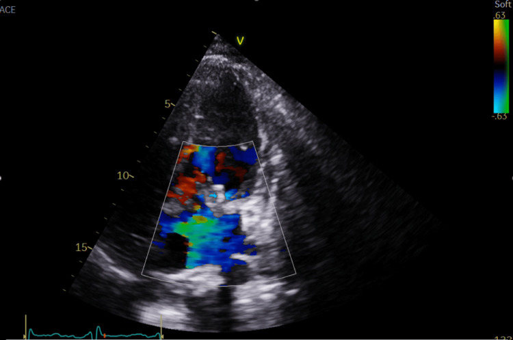 Figure 4