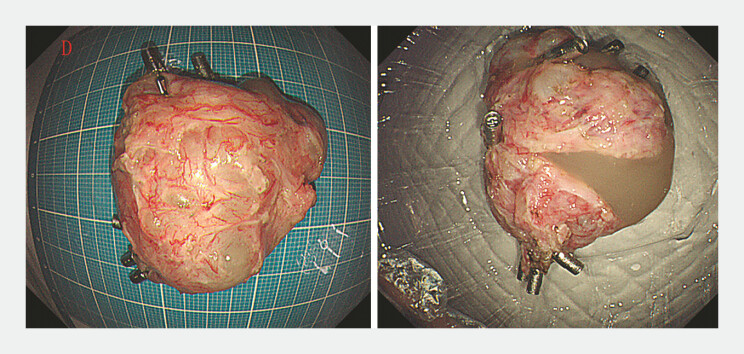 Fig. 4